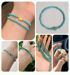 Malachite round beads with green banded “peacock” patterns, polished, assorted 4–12 mm — Peacock Veins.